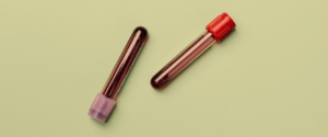 hiv test