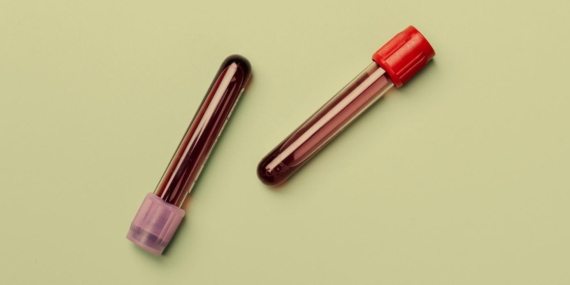 Kimlik bilgisi vermeden ücretsiz HIV testi