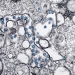 Parkinson Hastalığında Toksik Protein Birikimi Önleniyor