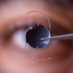 Photo,Of,Intra,Ocular,Lens,Iol,For,Treating,Cataract,Infront
